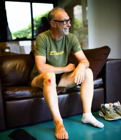 "Ho preso una buca e sono volato via...". Incidente in vespa per Linus 