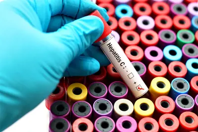 Un gene può bloccare le epatiti B, C e D. La scoperta che cambia tutto