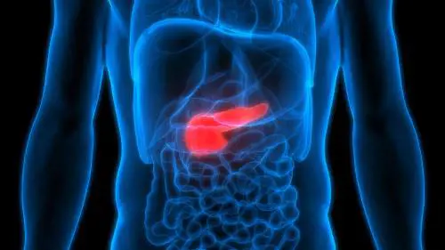 Tumore del pancreas, per la prima volta individuate le lesioni precancerose con una risonanza