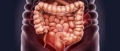 Cancro al colon, ecco i test genetici che consentono cure personalizzate anche con metastasi