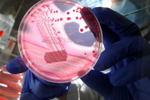 Resistenza agli antibiotici, nuova arma contro i batteri: ecco come eludono l'azione dei medicinali