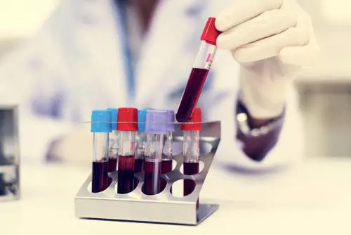 Schizofrenia, trovate nel sangue le "spie" della malattia