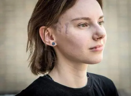 Maria, simbolo della resistenza bielorussa. Morta al fronte dove combatteva per Kiev