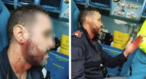 La foto che deve indignarvi, minaccia Pro-Pal alla polizia e Trump: quindi, oggi...