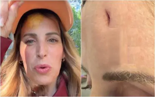  Incidente in vacanza per Cliomakeup, l'influencer finisce in ospedale: "Si vedeva l'osso"