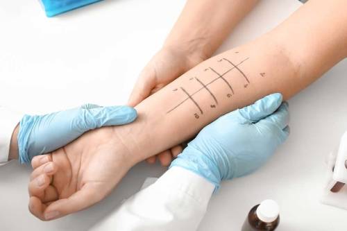 Quali test fare per valutare se si è allergici?