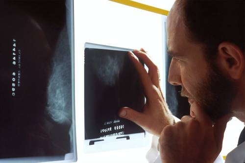 Mammografie gratuite per donne tra i 40 e i 49 anni. Prenotazioni il 31 maggio a Catania con “Maggio in…forma”
