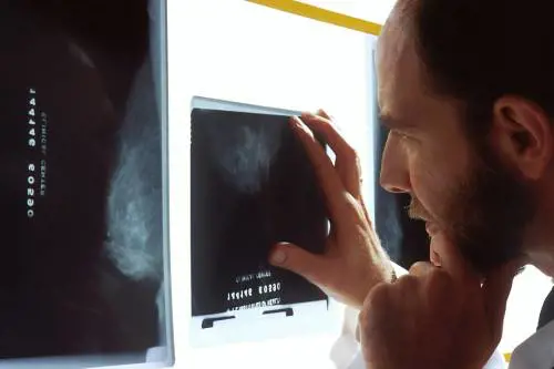 Mammografie gratuite per donne tra i 40 e i 49 anni.  Prenotazioni il 31 maggio a Catania con “Maggio in…forma”