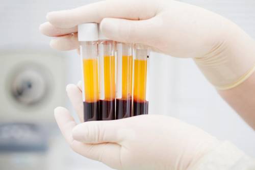 https://img.ilgcdn.com/sites/default/files/styles/md/public/foto/2025/06/11/sangue-plasma-2-free.jpeg?_=1749632403