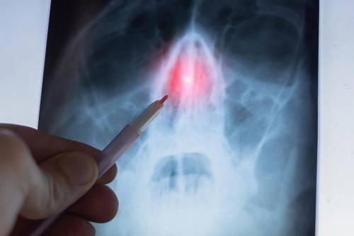 https://img.ilgcdn.com/sites/default/files/styles/md/public/foto/2025/06/19/naso-radiografia-free.jpeg?_=1750328103