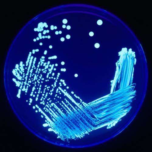 Allarme Legionella, a Milano un morto e casi in aumento: l'origine del focolaio
