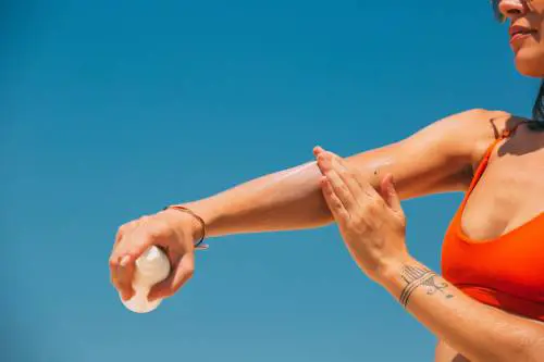 Scottature da sole, quali sono i rimedi naturali per dare sollievo alla pelle