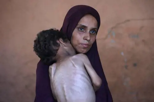 Gaza, l’orrore della "fame di massa"