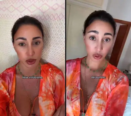 "Cos'ha fatto in faccia?" Bufera social su Belen: cosa è successo