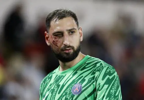 Quella cicatrice sul volto di Gigio che il PSG ha dimenticato troppo in fretta.