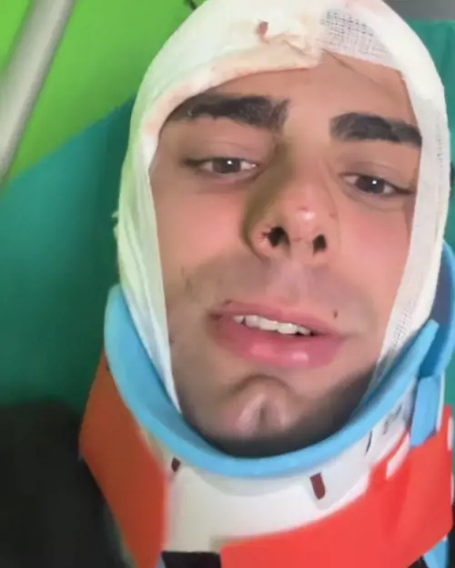 Alessandro, aggredito a Milano per un orologio: "Preso a martellate in testa. Ho rischiato di morire"