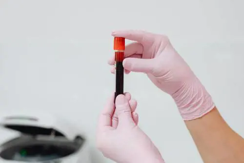 Check-up di settembre: quattro esami utili per chi ha più di 50 anni
