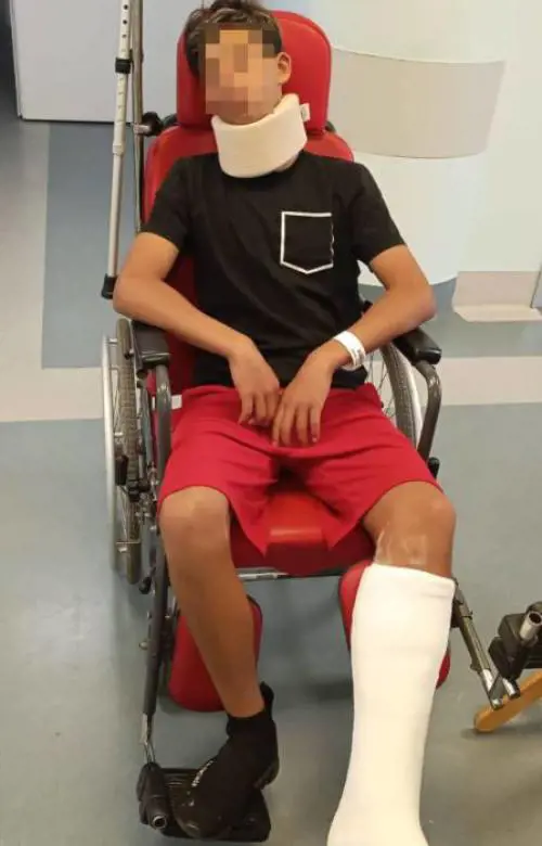 Papà in campo, botte al calciatore: rotti zigomo e malleolo