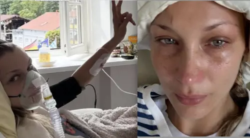 Bella Hadid in ospedale: preoccupano le sue condizioni a causa della malattia di Lyme