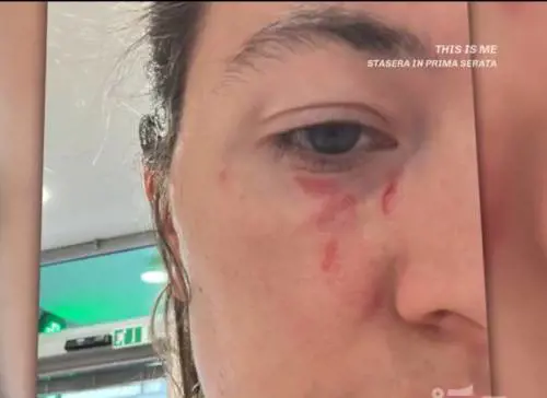 Screenshot foto "Dentro la Notizia"