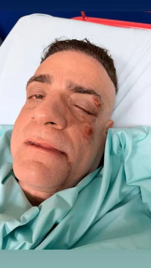 Aggredito il "Cicalone": lo youtuber vittima dei borseggiatori in metro a Roma