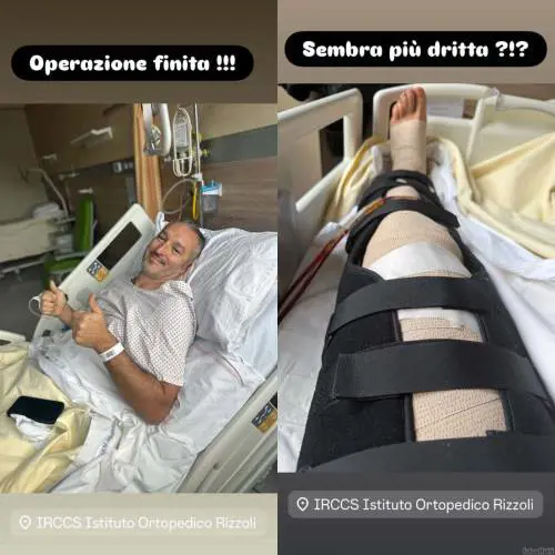 "Sembra più dritta?": Zambrotta operato alle gambe, come sta l'ex calciatore