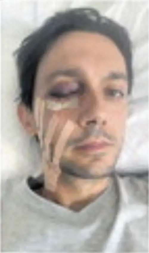 "Io sfigurato da un sasso. Neppure un messaggio dai responsabili del corteo"