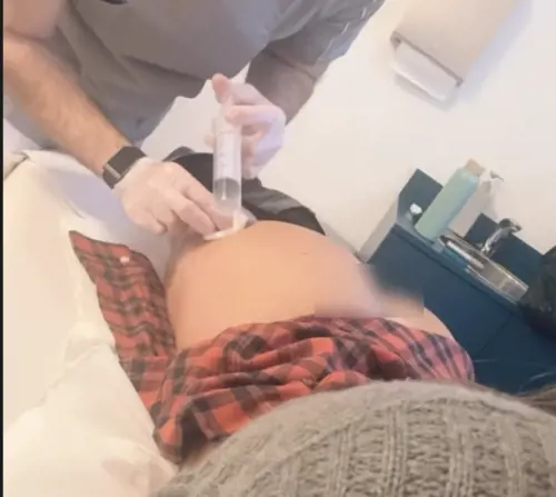 Belen mentre si sottopone al trattamento di ozonoterapia (Foto fonte Instagram)