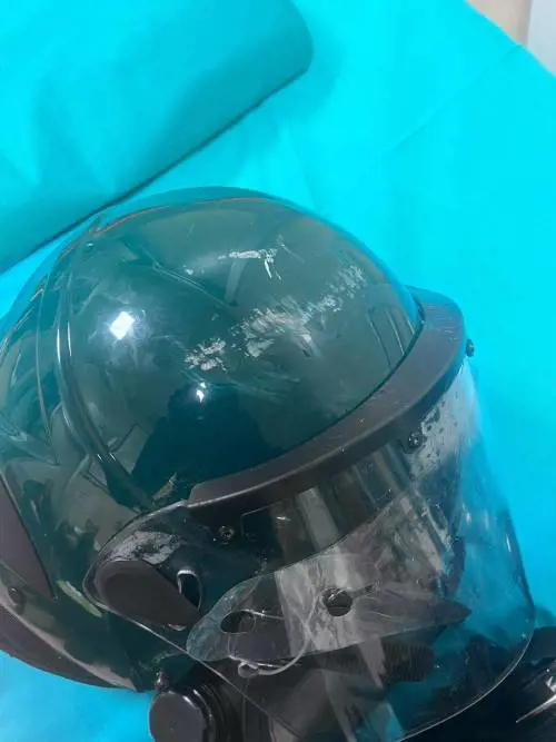 Gli effetti della violenza degli antagonisti contro le forze dell'ordine