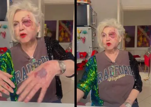 "La macchina, i sassi, il dolore incredibile", Wanna Marchi investita da un'auto a Milano