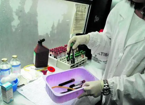 Epatite A, 113 casi in Campania (uno grave): colpa dei frutti di mare