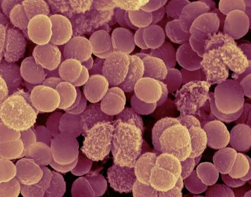 Il batterio che sopravvive allo spazio (e forse ci ha preceduti su Marte). Come diceva Nanni Bignami "i marziani siamo noi"?