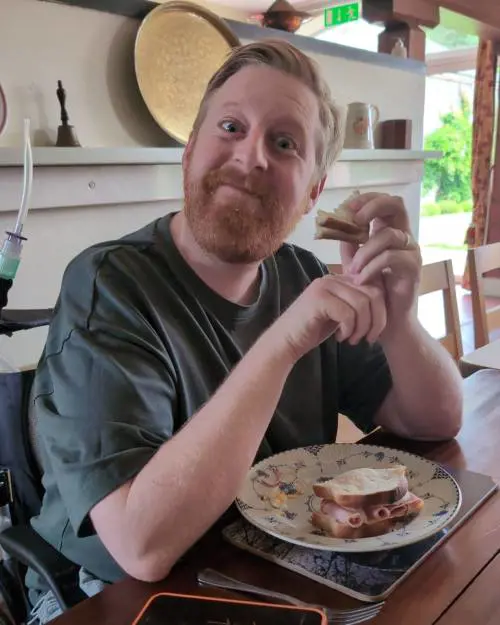 Muore a 35 anni Michael Patrick: dal teatro al “Trono di Spade”, chi era l’attore nordirlandese