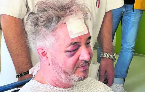 Feriti in miglioramento. Lo chef: "Io miracolato. Ho visto l'auto accelerare a una velocità pazzesca"