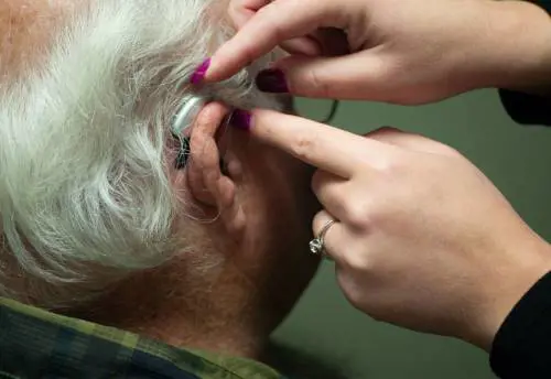 Acufene e calo dell’udito, i segnali da non trascurare: quando e come intervenire