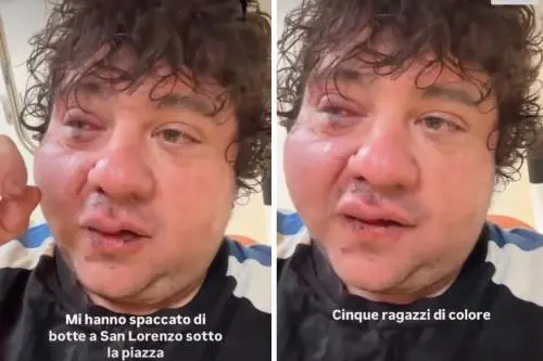 "Mi hanno spaccato di botte". Ex concorrente di X Factor aggredito da cinque stranieri
