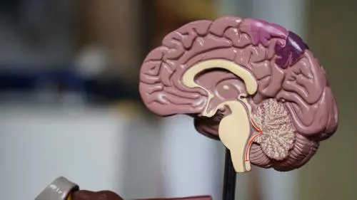 Cervello più piccolo per i criminali recidivi: lo svela la risonanza magnetica