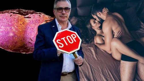 Vaiolo delle scimmie, i virologi vogliono dirci con chi fare sesso