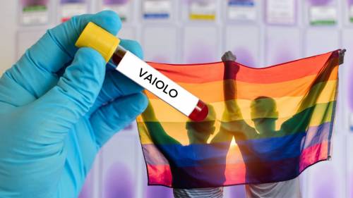 Vaiolo, il partito gay nega la scienza: “Non siamo più a rischio”