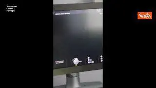 Chiara Ferragni e Fedez, l'ecografia in 3d della figlia