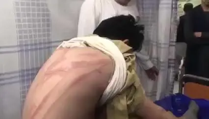 Un ragazzo frustrato dai talebani