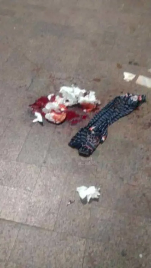 Aggressione horror in Porta Garibaldi: turista accoltellato al volto