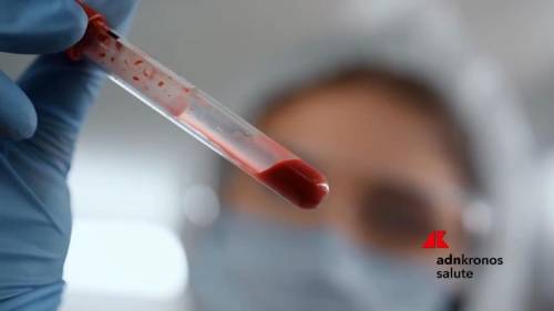 Giornata epatiti, esperti: "Raggiungere obiettivi Oms. Accelerare e ampliare gli screening"