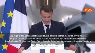 Macron sul palco con occhio gonfio scherza: Un riferimento all'Eye of the Tiger