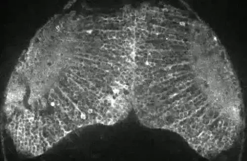 Come si "accende" il cervello del pesce quando vede la preda