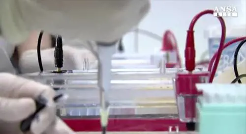 Terapia genica col virus Hiv