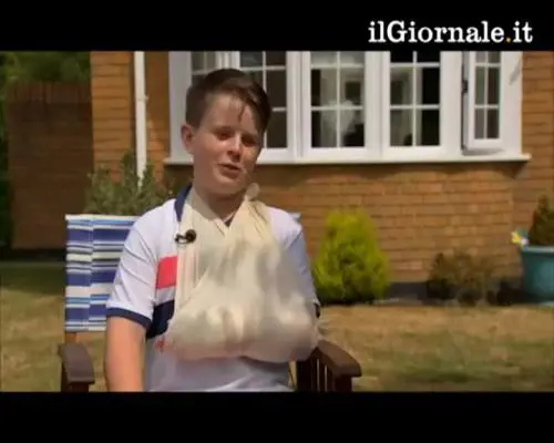 La punizione di Cristiano Ronaldo rompe il polso a bimbo