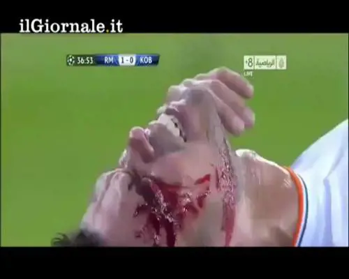 Pepe ricucito a bordo campo