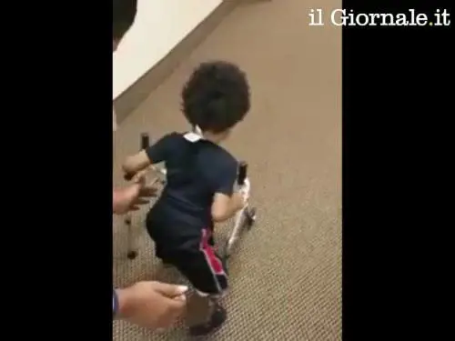Kayden, 2 anni e i primi passi con la protesi alle gambe