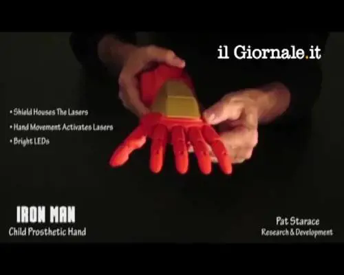 Protesi artificiale  come Ironman  per bimbo hawaiano